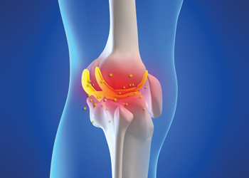 Fortune Journal of Rheumatology